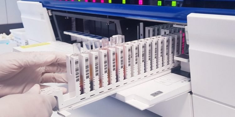 Laboratório do Hospital Delphina Aziz já realizou mais de meio milhão de exames em 2021