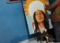 Artista visual PCD faz tratamento para receber próteses