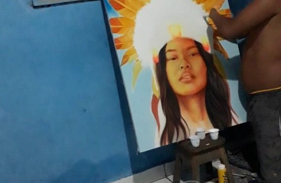 Artista visual PCD faz tratamento para receber próteses